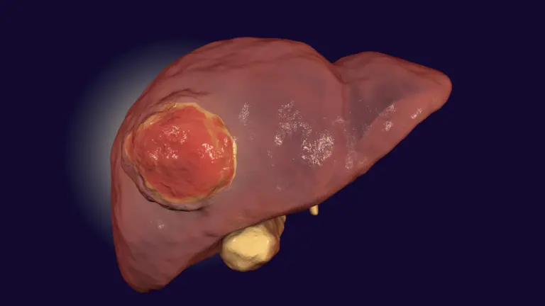 FDA-approved drug may help immunotherapy treat rare liver cancer