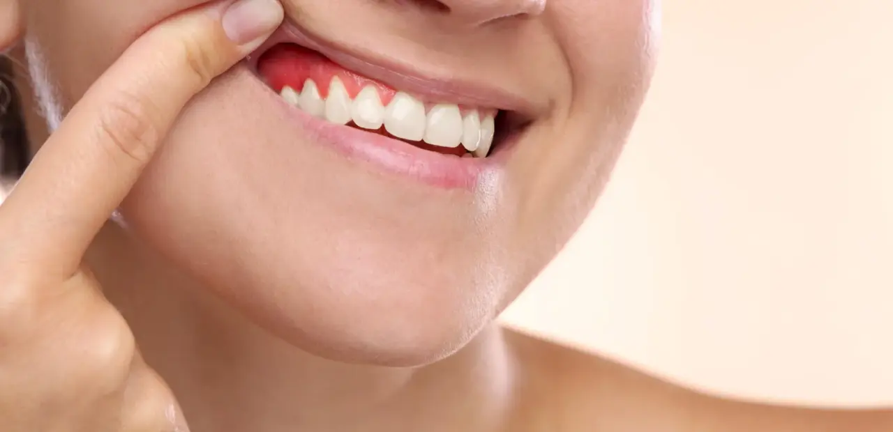 Jackfruit latex and pomegranate peel show promise for gum disease repair
