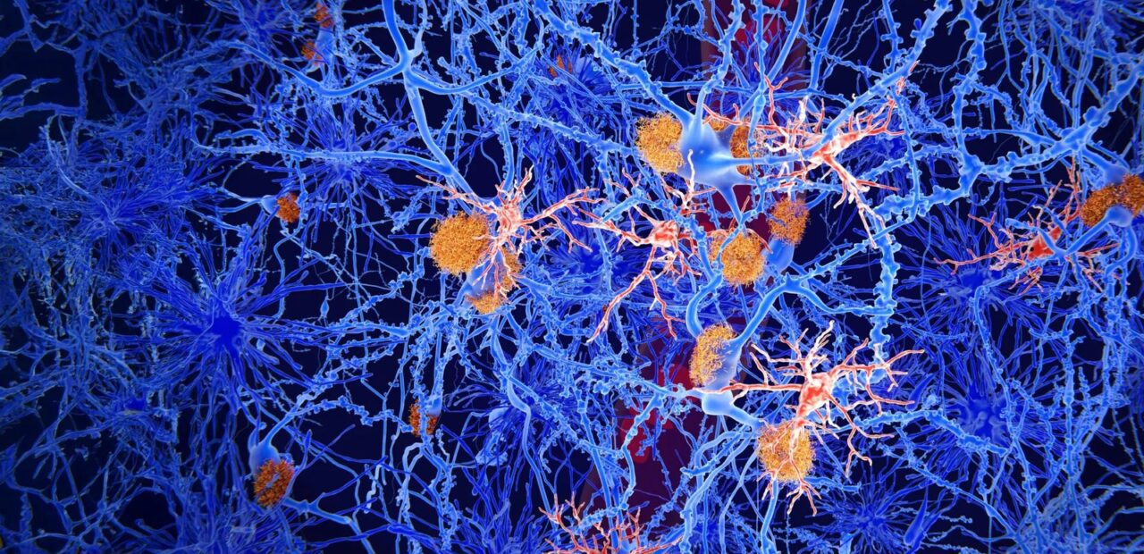 Scientists identify molecule that may restore brain immune cells in Alzheimer’s