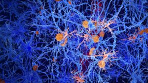 Scientists identify molecule that may restore brain immune cells in Alzheimer’s