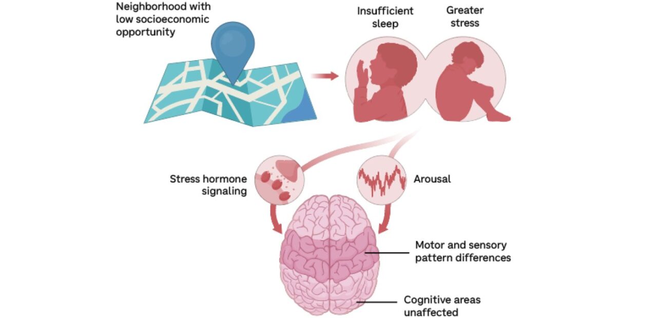 Study Finds Socioeconomic Factors Shape Children's Brain Development
