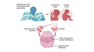 Study Finds Socioeconomic Factors Shape Children's Brain Development