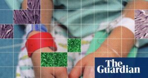Unapproved stem cell treatments for autistic children grow in US