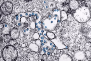 Cyclospora infections surge past record 4,700 cases, Michigan officials eye lettuce