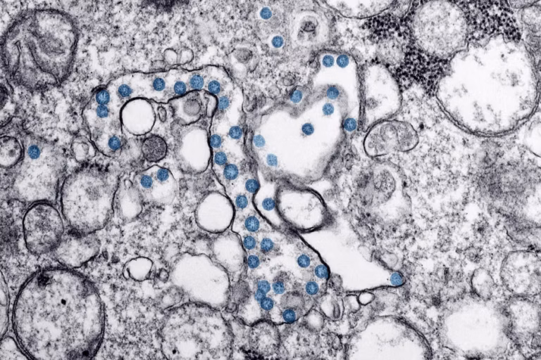 Cyclospora infections surge past record 4,700 cases, Michigan officials eye lettuce