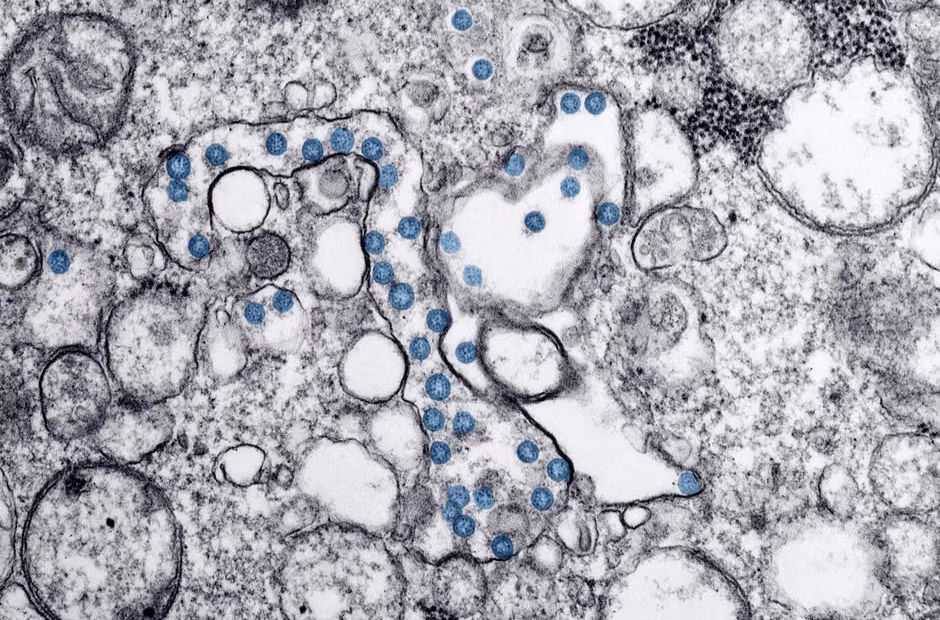 Cyclospora infections surge past record 4,700 cases, Michigan officials eye lettuce