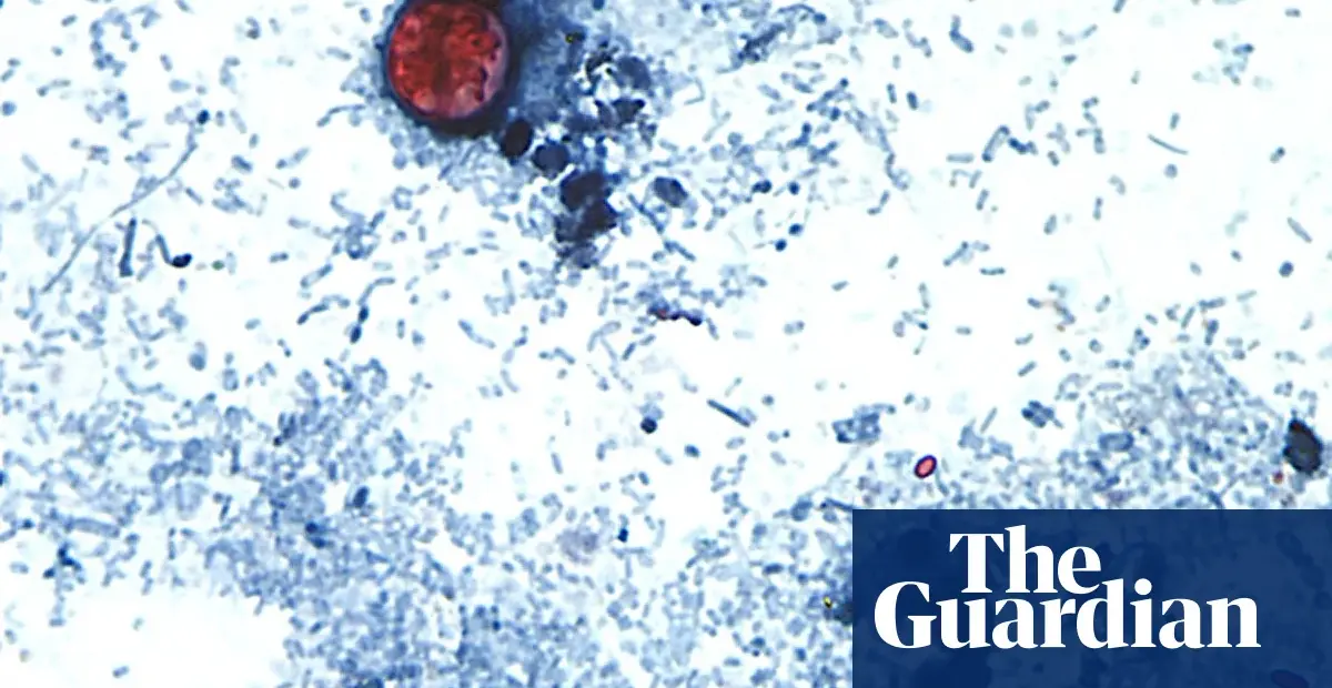 Cyclosporiasis outbreak spreads to 31 states, source investigation ongoing
