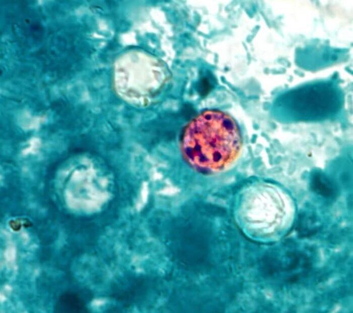 FDA and CDC Investigate New Cyclospora Outbreak With 72 Cases