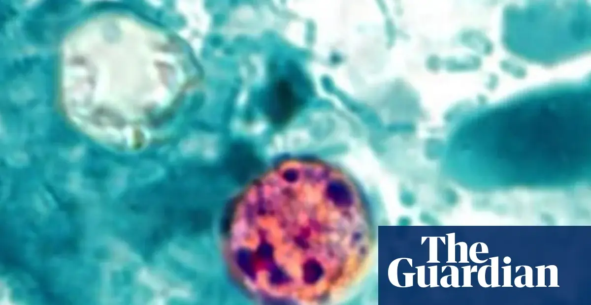 Former FDA official criticizes cyclospora response as near 'catastrophic'