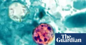 Former FDA official criticizes cyclospora response as near catastrophic
