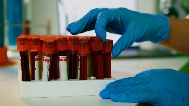 NHS trials AI blood test to reduce invasive cancer exams for women